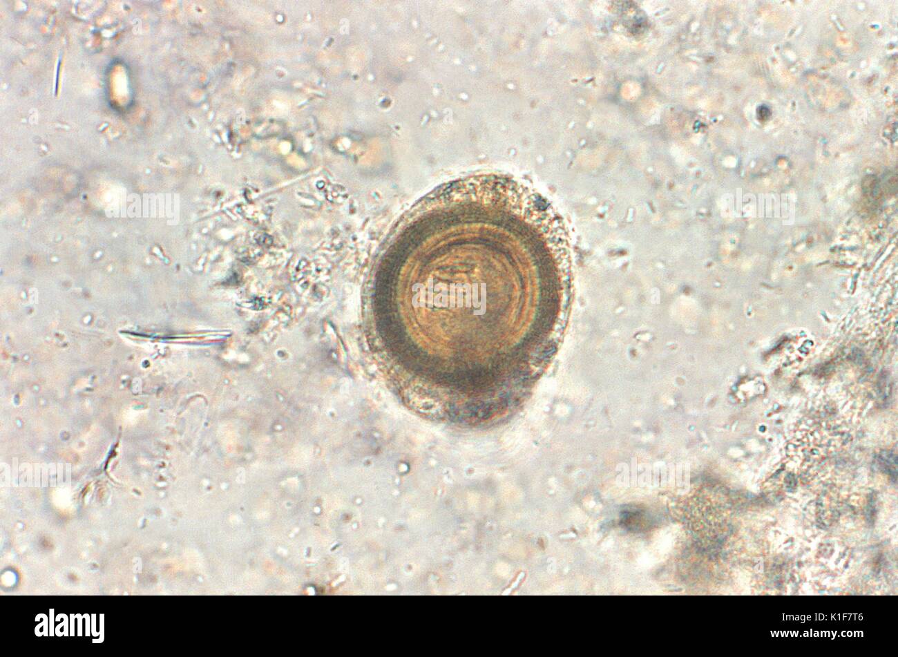 Egg of Taenia sp. Hooklets visible. Tapeworm, cestode, parasite. Image courtesy CDC/Dr. Mae Melvin, 1979. Stock Photo