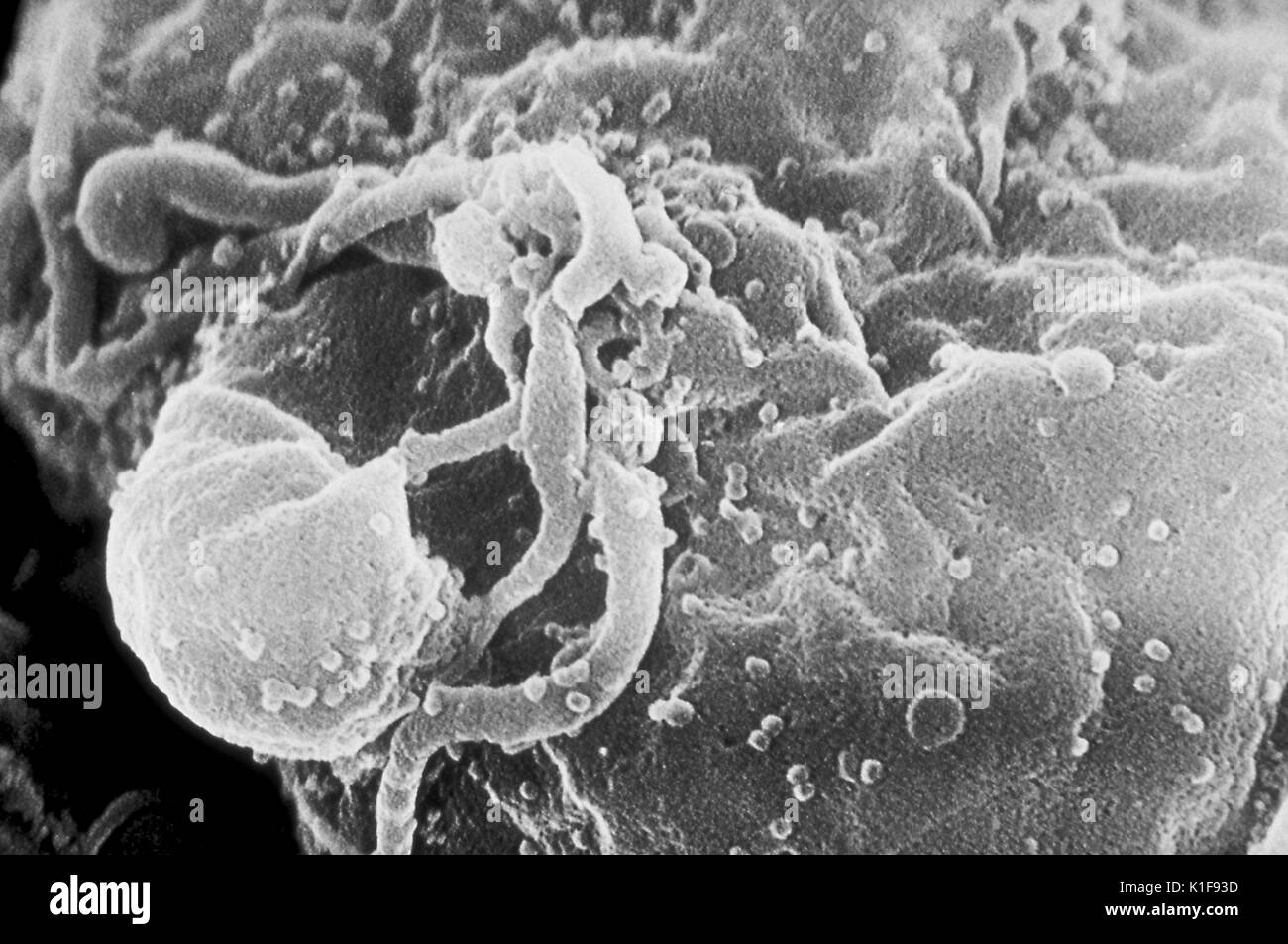 Scanning electron micrograph of HIV-1 virions budding from a cultured lymphocyte. See PHIL 10000 for a colorized view of this image, and PHIL 14270, for a black and white version, both viewed at a lower magnigication. Multiple round bumps on cell surface represent sites of assembly and budding of virions. Image courtesy CDC/C. Goldsmith, P. Feorino, E. L. Palmer, W. R. McManus. 1974. Stock Photo