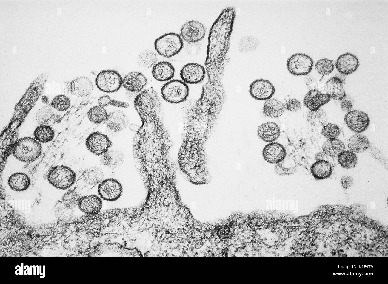 Transmission electron micrograph of the Sin Nombre Hantavirus, Hantaviruses that cause Hantavirus pulmonary syndrome (HPS) are carried in rodent droppings, especially the deer mouse Incubation lasts for 1?5wks Sickness begins with fever and muscle aches, followed by shortness of breath and coughing Image courtesy CDC/Cynthia Goldsmith, 1993. Stock Photo