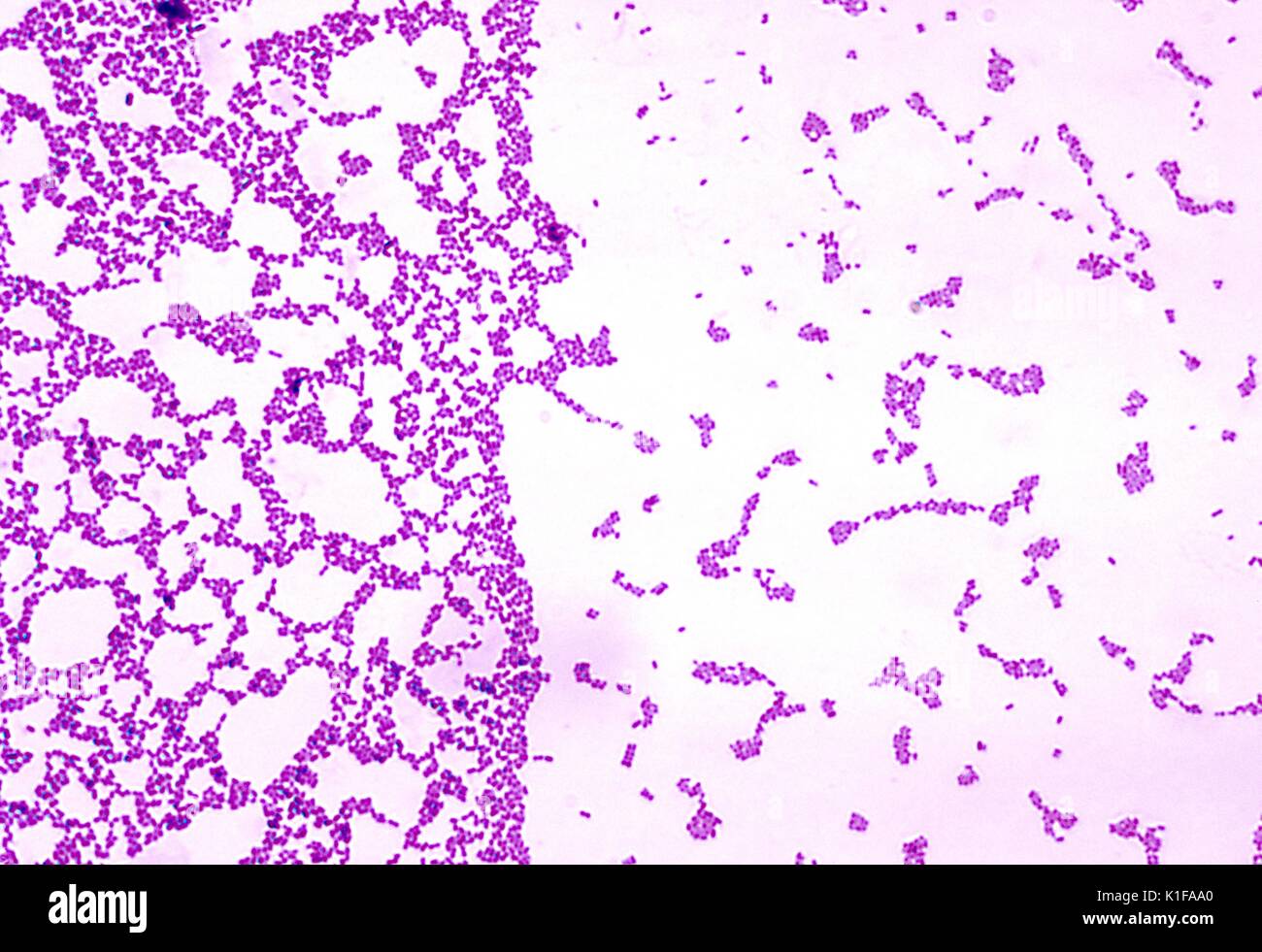 A photomicrograph of Streptococcus mutans bacteria using Gram stain ...