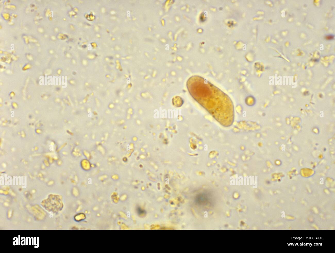 This photomicrograph depicts the cyst of an Iodamoeba buetschlii ...
