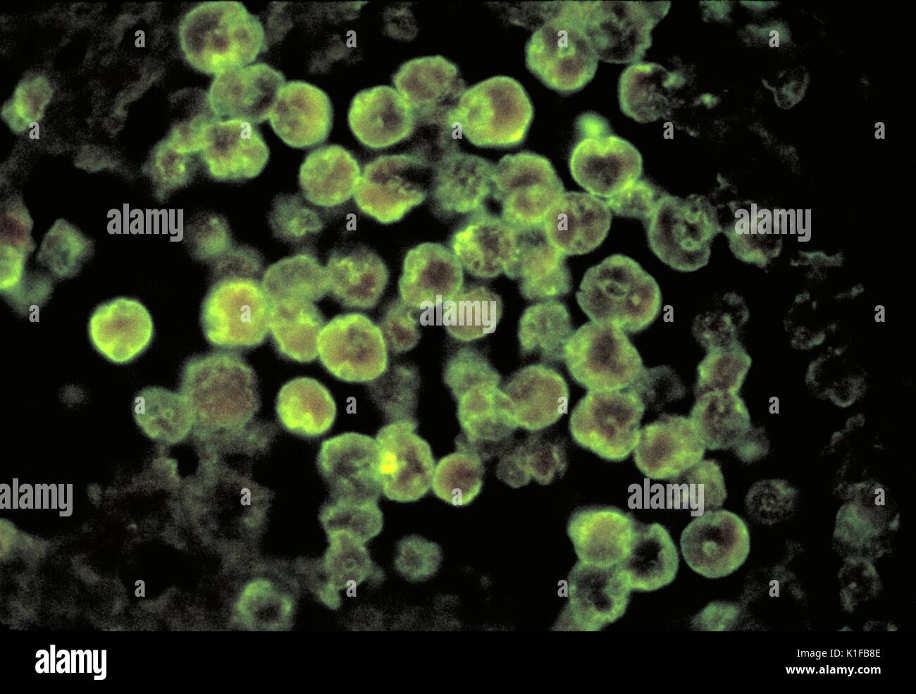 Naegleria fowleri amoeba High Resolution Stock Photography and Images