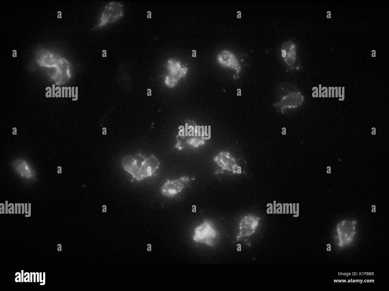 This photomicrograph depicts a positive indirect fluorescent antibody (IFA) test for Giardia lamblia parasites. Image courtesy CDC/Dr. Govinda S. Visvesvara, 1978. Stock Photo