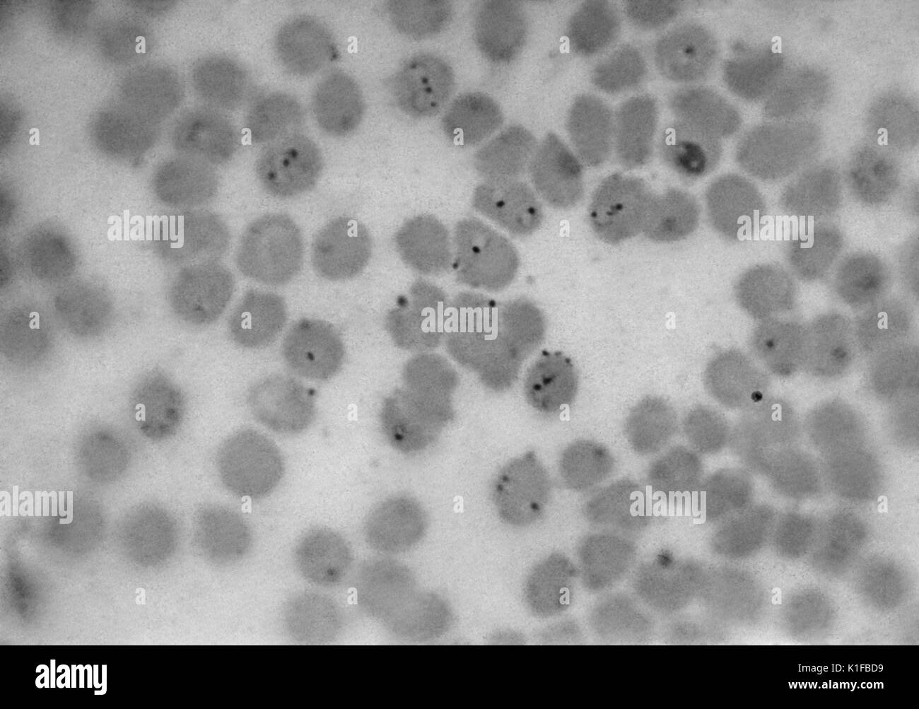 Plasmodium Falciparum Stock Photos & Plasmodium Falciparum Stock Images