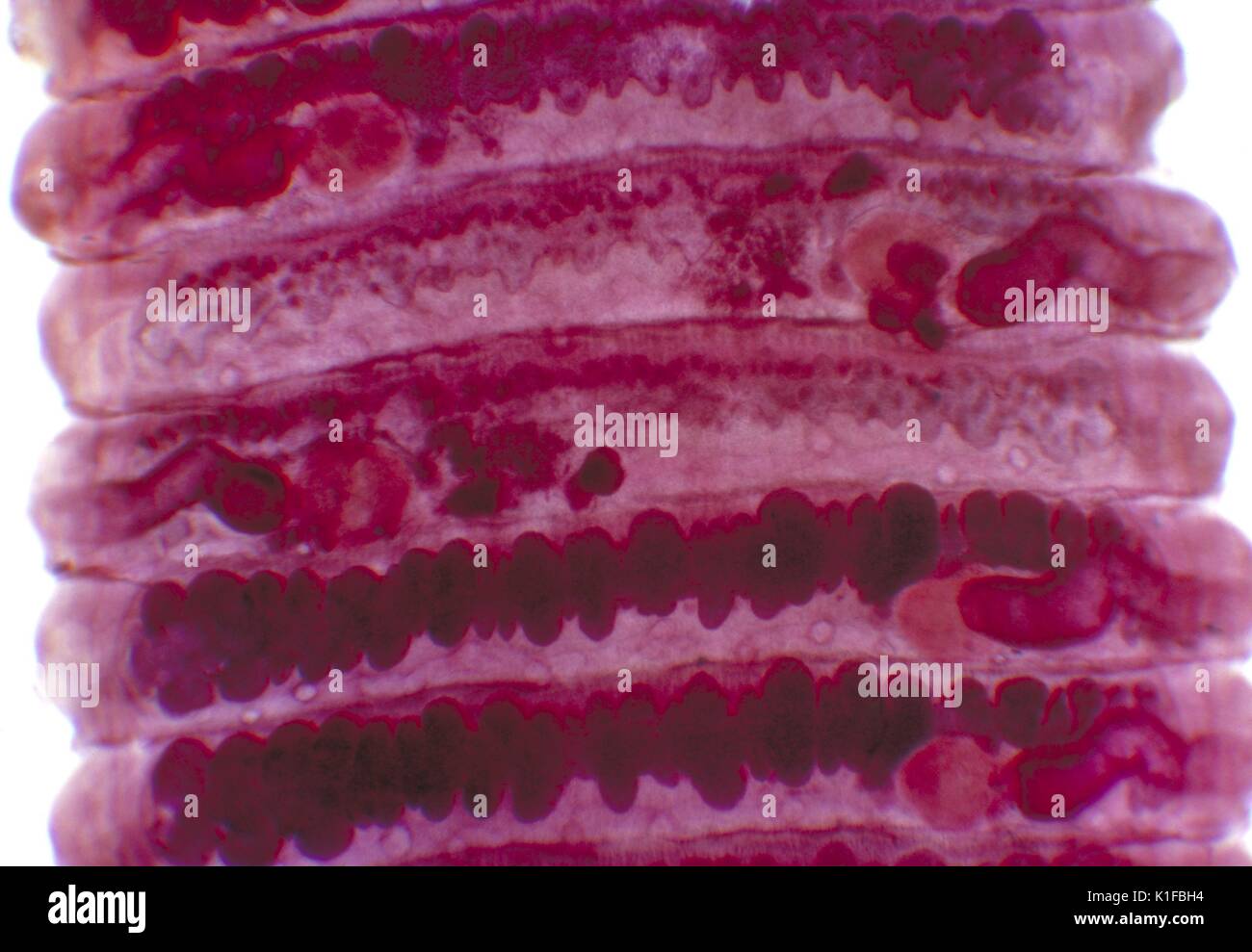 Proglottids of human tapeworm Bertiella studeri . Parasite. Image courtesy CDC/Dr. George R. Healy, 1962. Stock Photo