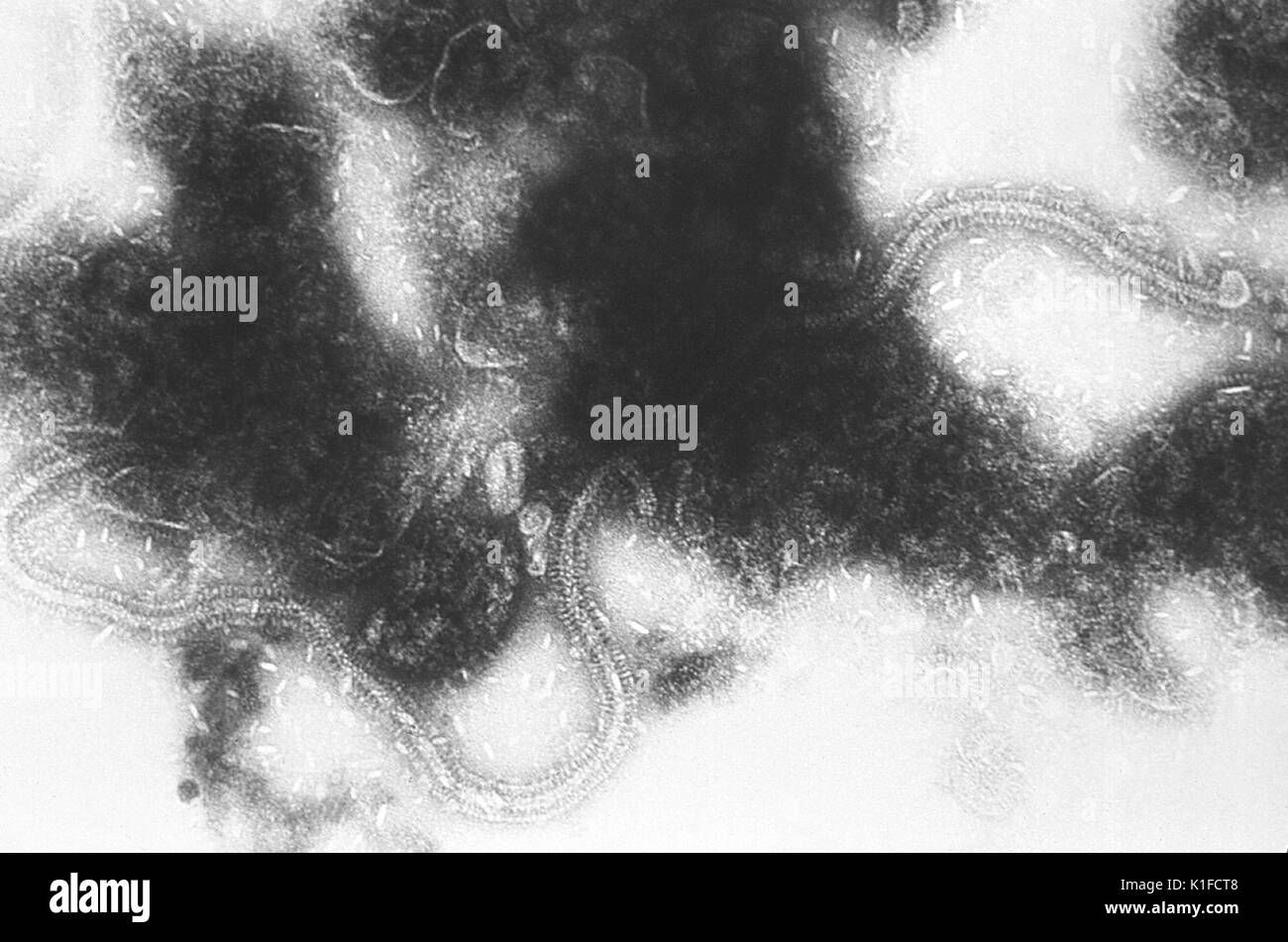 This electron micrograph depicts the Respiratory Syncytial Virus (RSV) pathogen. RSV is a negative-sense, enveloped RNA virus. The virion is variable in shape and size, with a diameter ranging between 120 and 300 nm, and is unstable in the environment surviving only a few hours on environmental surfaces. Image courtesy CDC/Dr. Erskine Palmer, 1981. Stock Photo