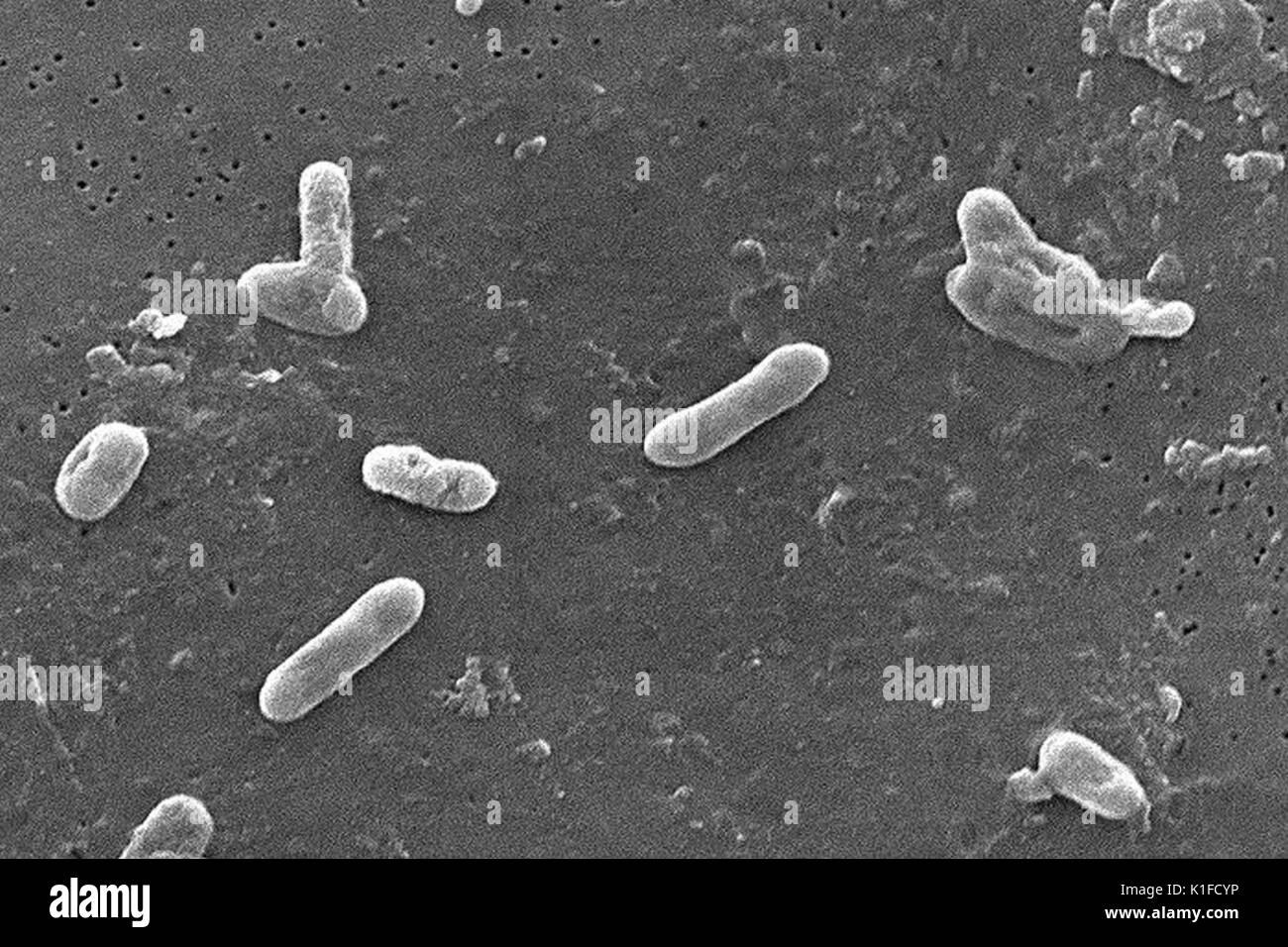 This scanning electron micrograph (SEM) depicted a number of Gram-negative Bordetella bronchiseptica coccobacilli bacteria. This organism is commonly found to be the cause of respiratory tract infections in dogs, as well as human beings whose immune system had been compromised including those who are infected by the HIV virus. Genetically very similar and closely related to B. pertussis, which is evidenced in the fact that it too possesses the gene to express pertussis toxin, this Bordetella member does not produce the toxin like its fellow genus member. This bacterium can cause a wide range o Stock Photo