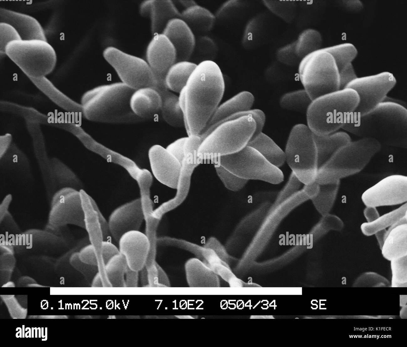 This scanning electron micrograph (SEM) depicts a magnified view of a colony of the dematiaceous filamentous fungus Curvularia geniculata, revealing the morphologic details of the organism?s hyphae, and conidiophores topped with spore-containing conidia. Though normally found living in soil or decaying vegetation, Curvularia geniculata is pathogenic to humans, causing wound infections known as phaeohyphomycosis, which are fungal infections that can involve a number of bodily structures including the skin, respiratory tract, and brain, to name a few. Image courtesy CDC/Robert Simmons, Janice Ha Stock Photo