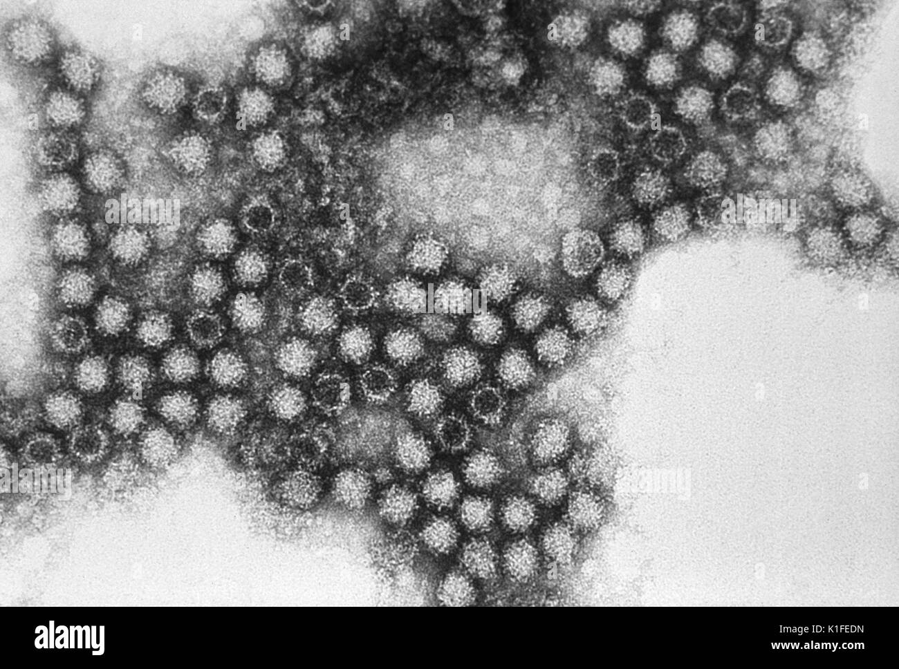 This electron micrograph reveals the morphologic traits exhibited by the feline calicivirus (FCV), a Caliciviridae family member, Feline calicivirus virions average 35nm - 40nm in diameter, and exhibit cup-like surface depressions, which sometimes manifest as a 'Star of David' array. The feline symptoms include upper respiratory symptoms with oral ulcerations, and pneumonitis. Image courtesy CDC/Dr. Erskine Palmer., 1981. Stock Photo