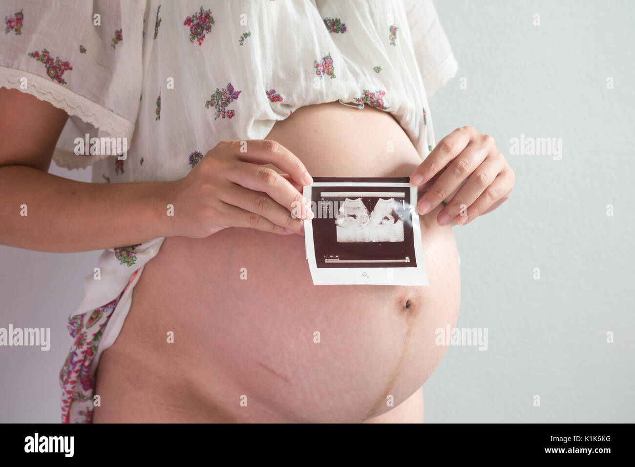 Closeup Pregnant Woman Holding Ultrasound Scan Stock Photo Alamy