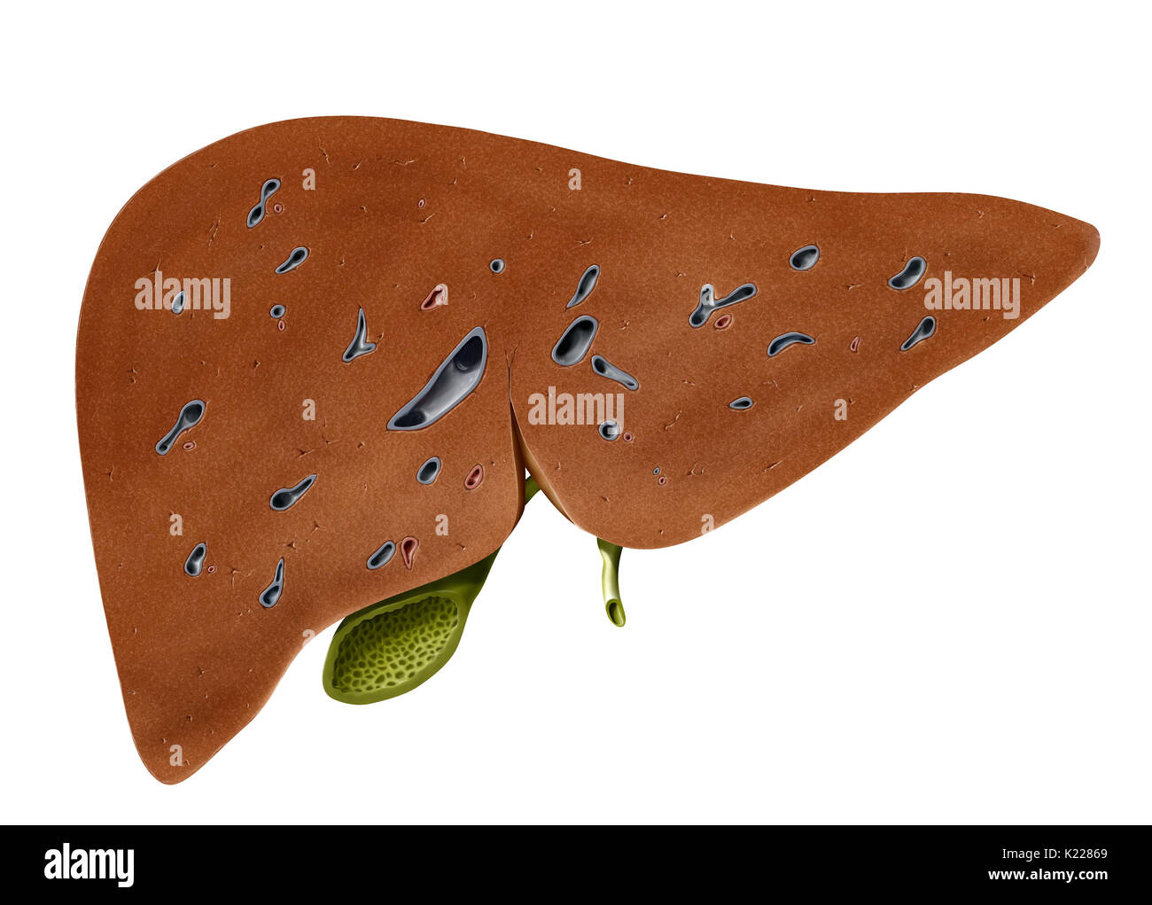 This image is cross section of the liver the gallbladder Cut Out Stock Images & Pictures Alamy