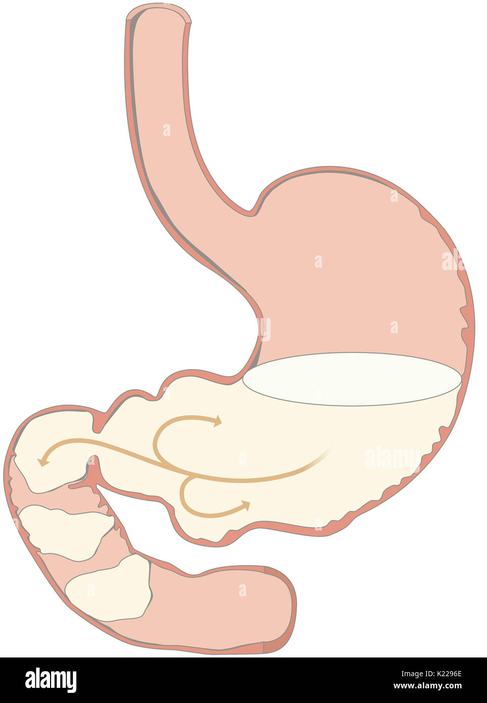 This image shows the alimentary bolus in the stomach and going through the duodenum. Stock Photo