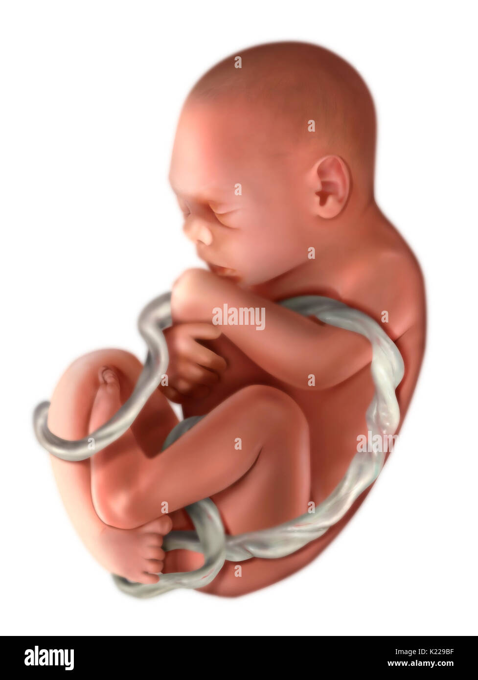 7 Month Fetus Stock Photos & 7 Month Fetus Stock Images ...