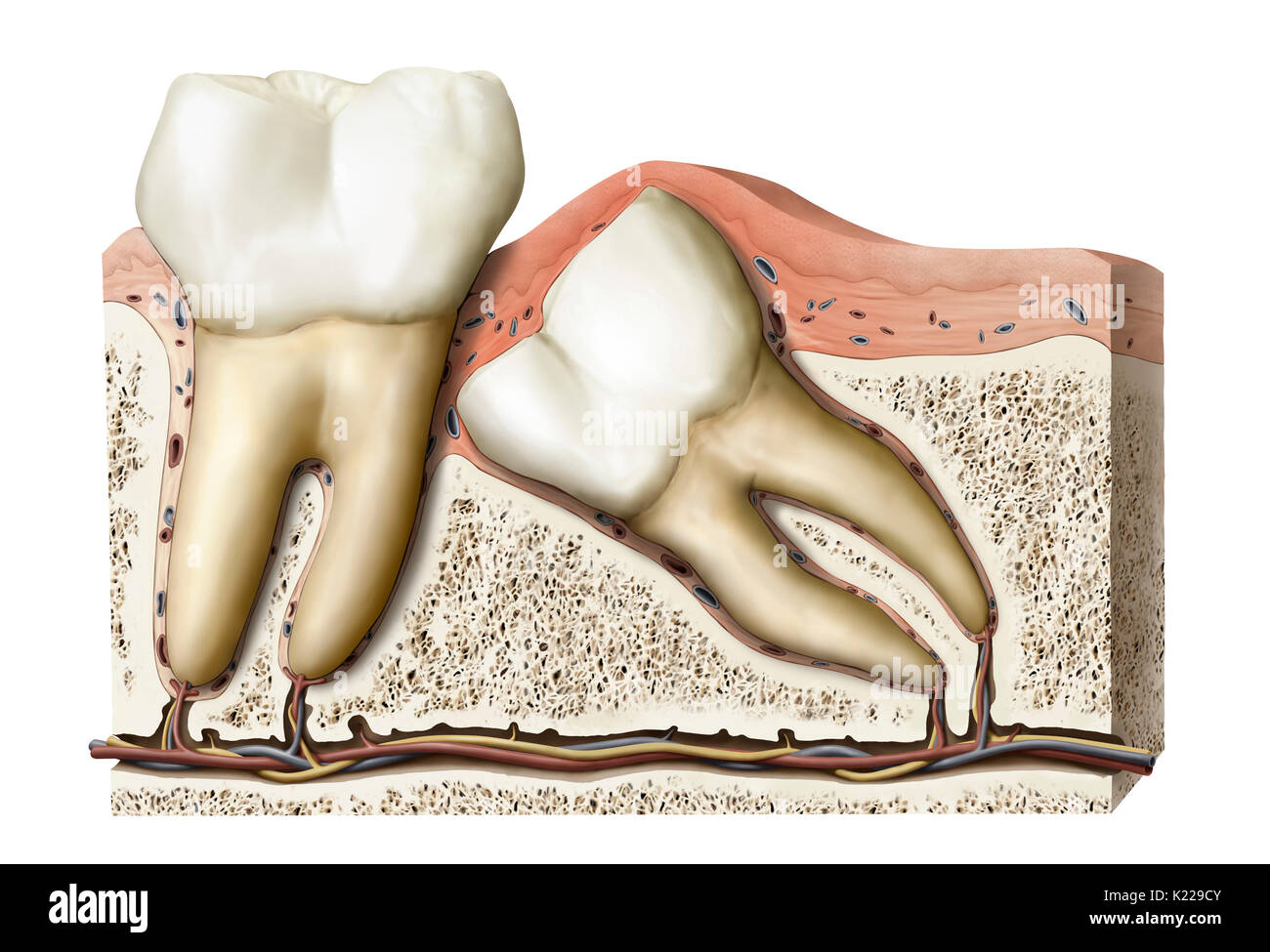 While growing, the wisdom teeth can remain under the gums or in the bone, or even pop up in an abnormal position. Stock Photo
