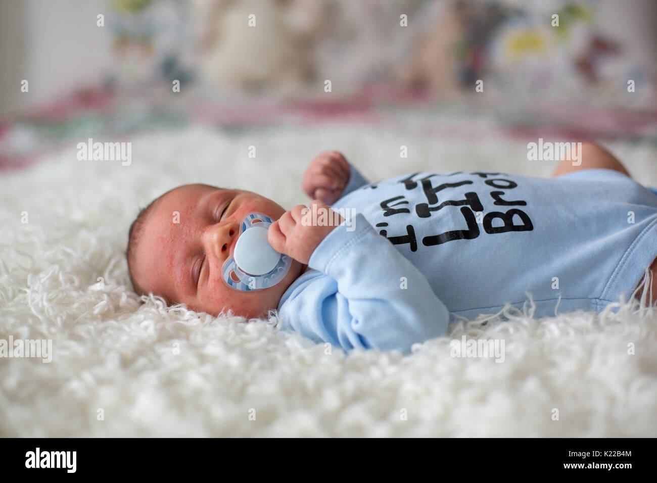 Little newborn baby sleeping with pacifier, baby with scin rash, child