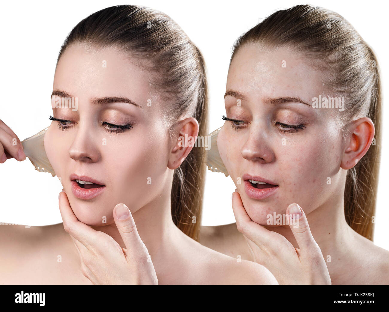 Woman remove her old dry skin from face. Stock Photo