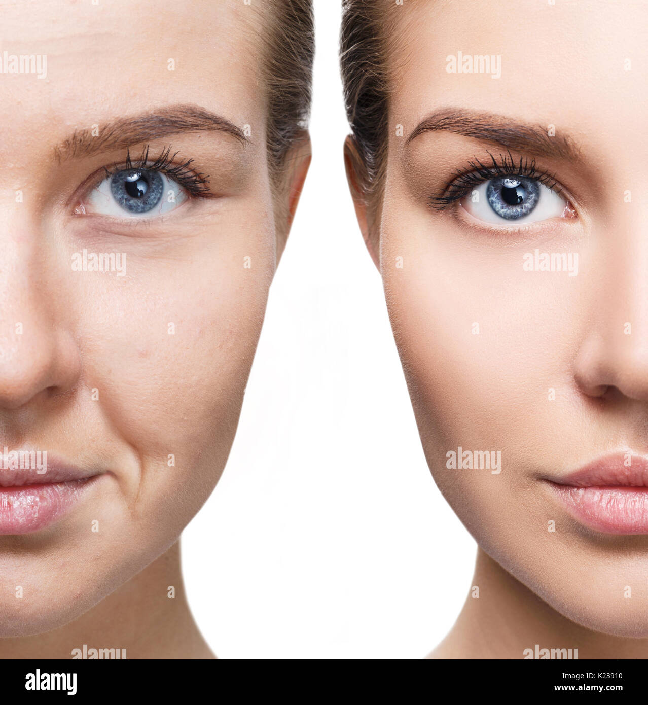 Woman's face before and after rejuvenation. Stock Photo