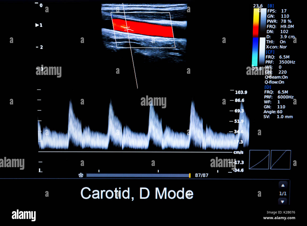 Colourful image of modern ultrasound monitor. Ultrasonography machine