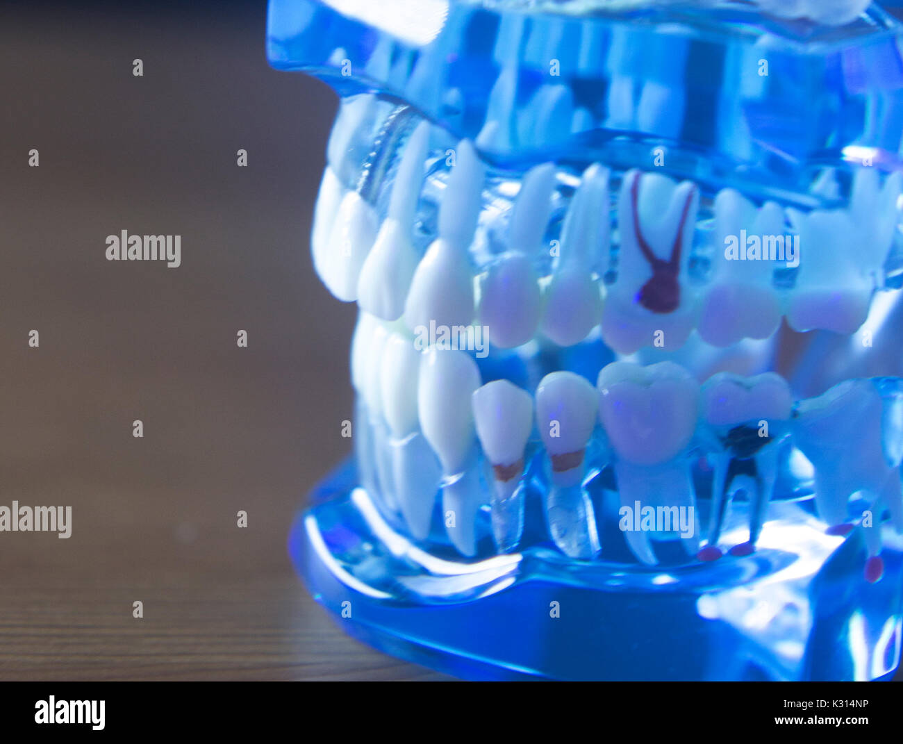 Dental teeth orthodontic dentistry teachng model with gums, tooth
