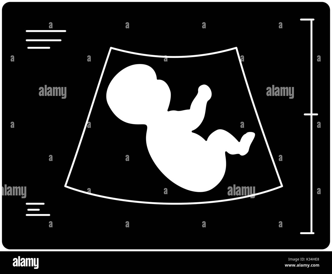 Pregnant belly ultrasound Black and White Stock Photos & Images - Alamy