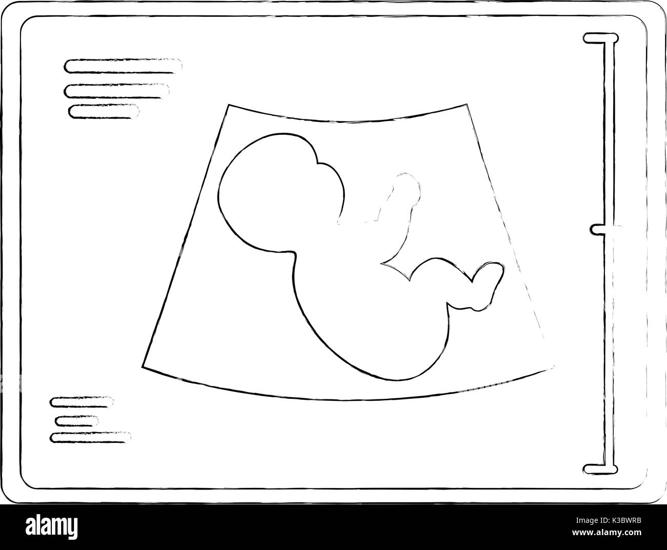 Pregnant belly ultrasound Black and White Stock Photos & Images - Alamy