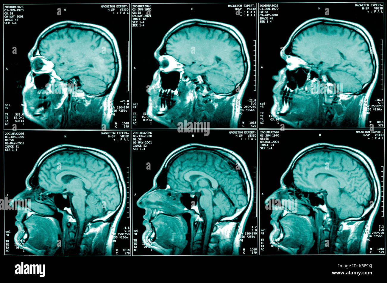 nuclear magnetic resonance imaging, magnetic resonance imaging Stock Photo  - Alamy