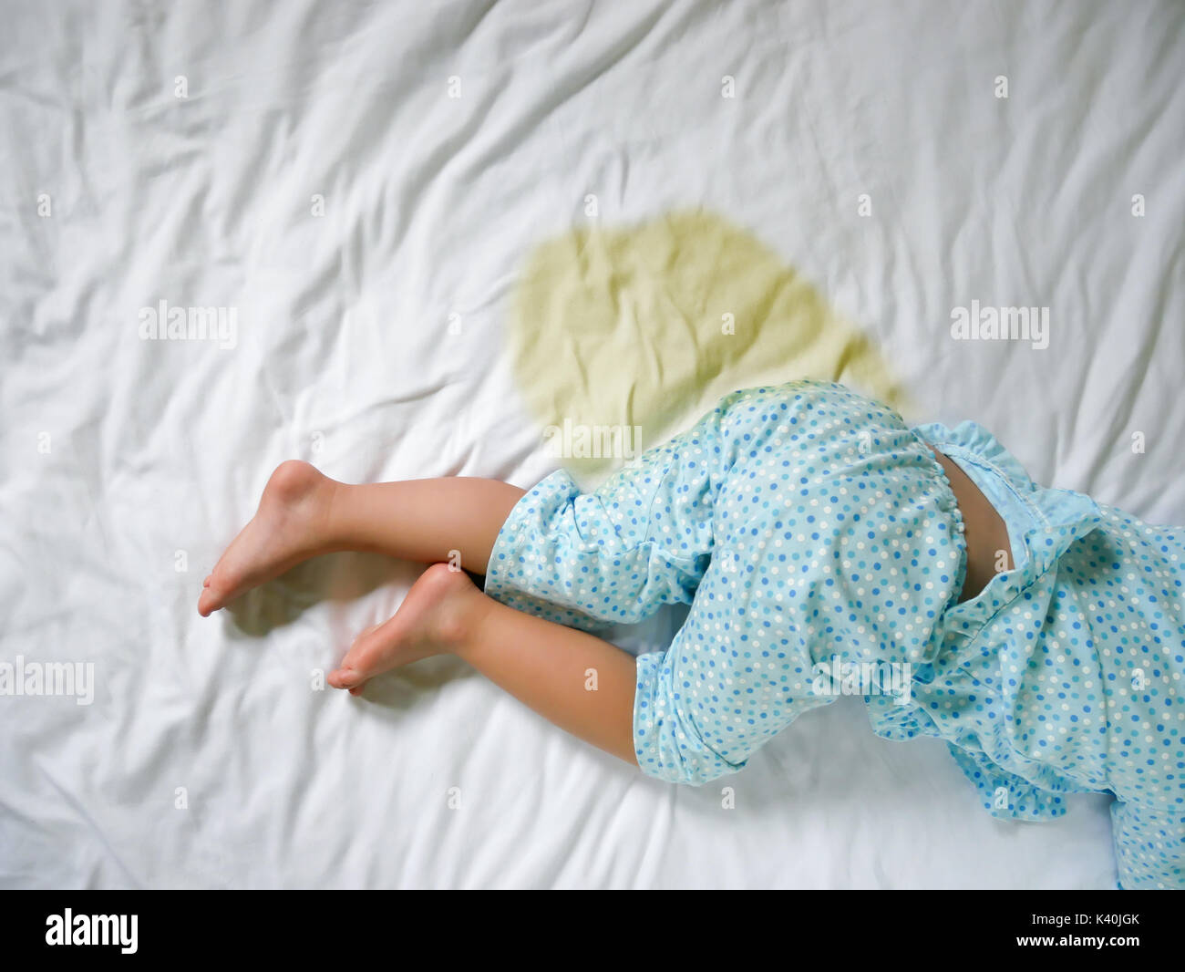 Bedwetting Child pee on a mattress,Little girl feet and pee in bed