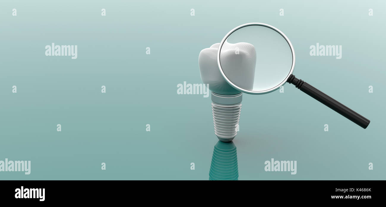 Dental implant and magnifying glass isolated on green background. 3d ...