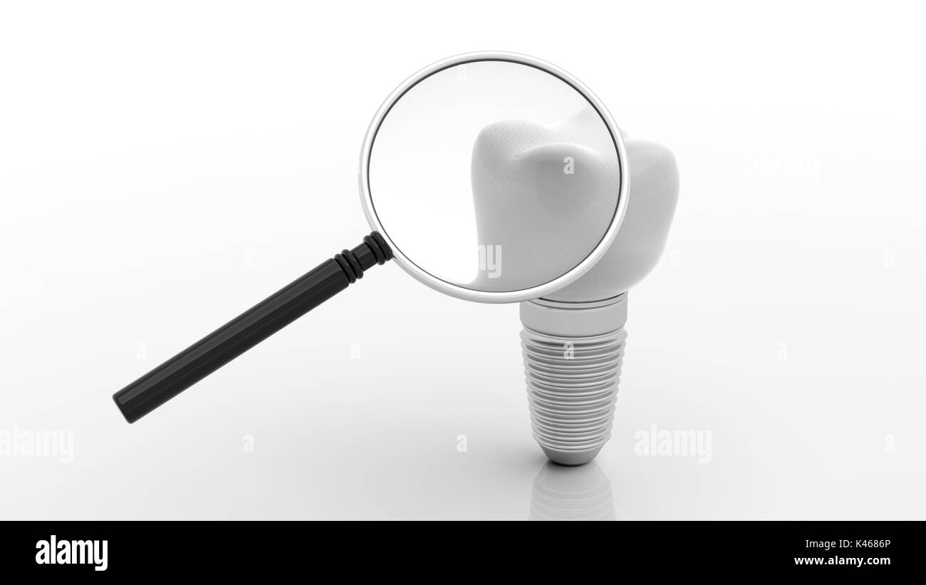 Dental implant and magnifying glass isolated on white background. 3d illustration Stock Photo