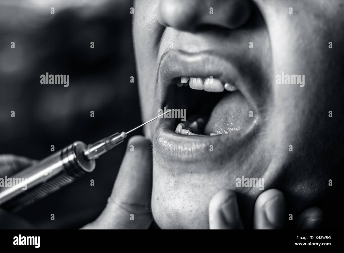 A mouth having a painkiller injection Stock Photo Alamy