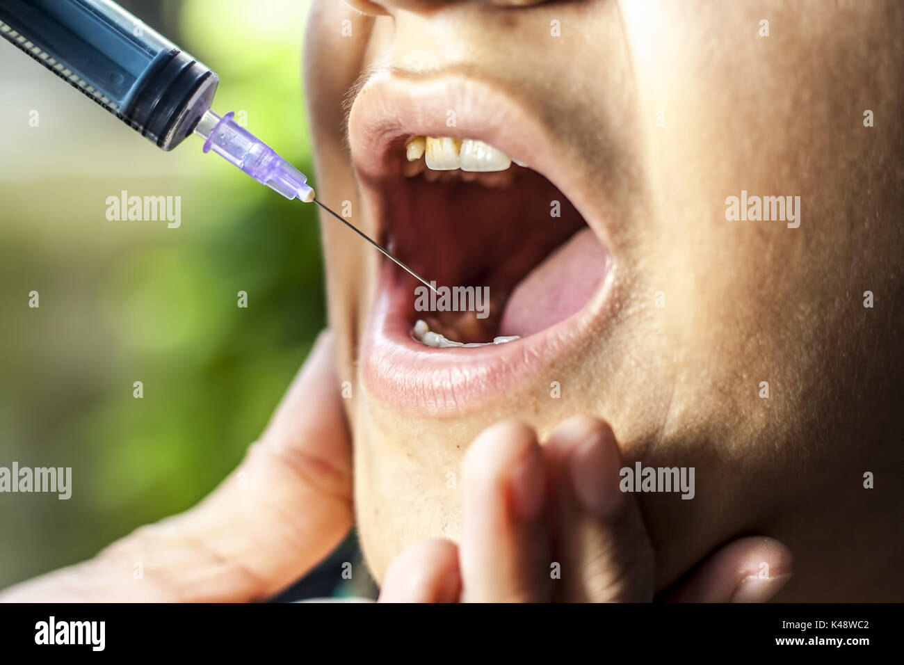 A mouth having a painkiller injection Stock Photo Alamy