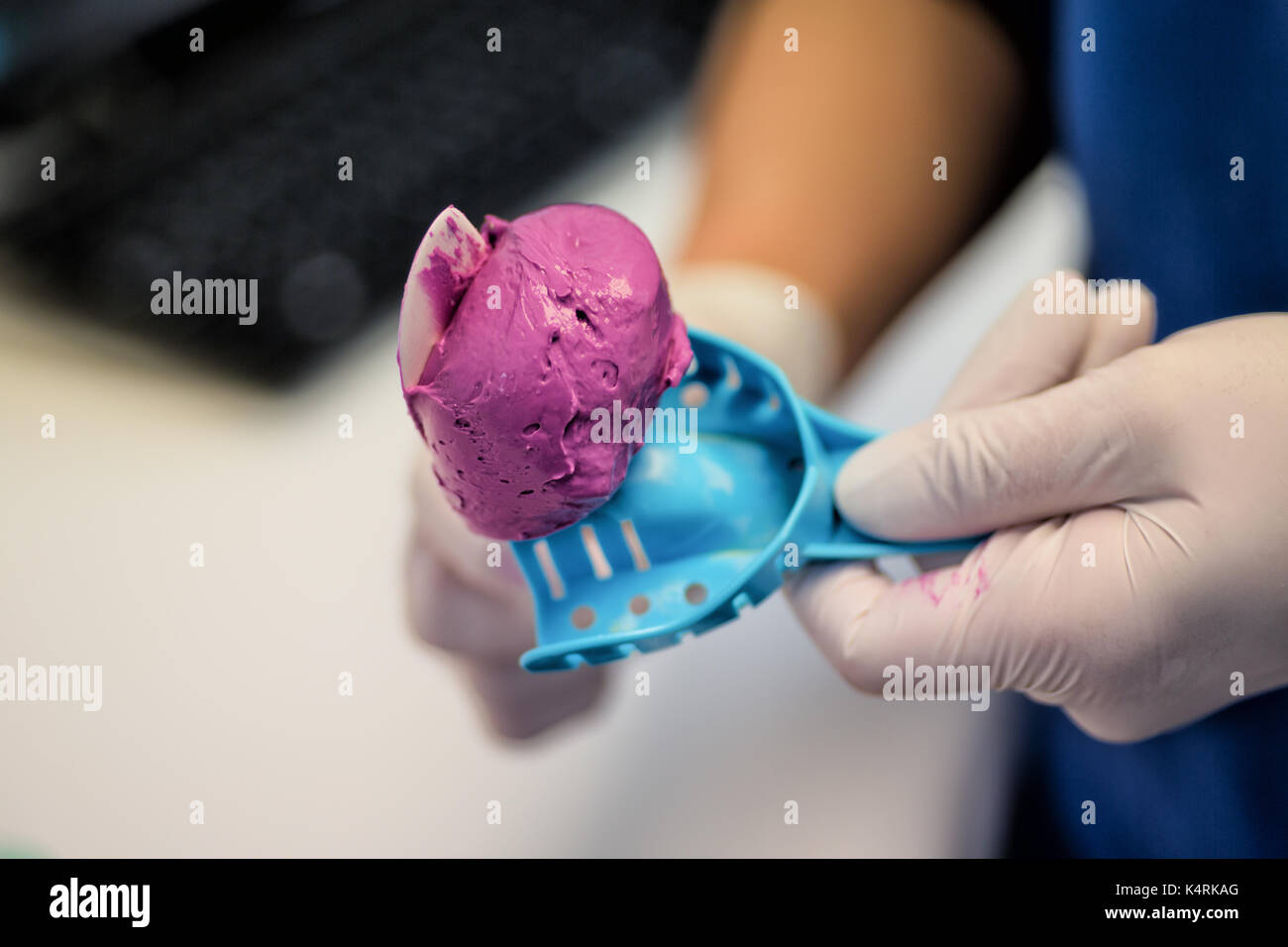 Mixed Dental Alginate Impression material used to make negative impressions of the teeth and soft tissues in the mouth for diagnostic studies. Stock Photo