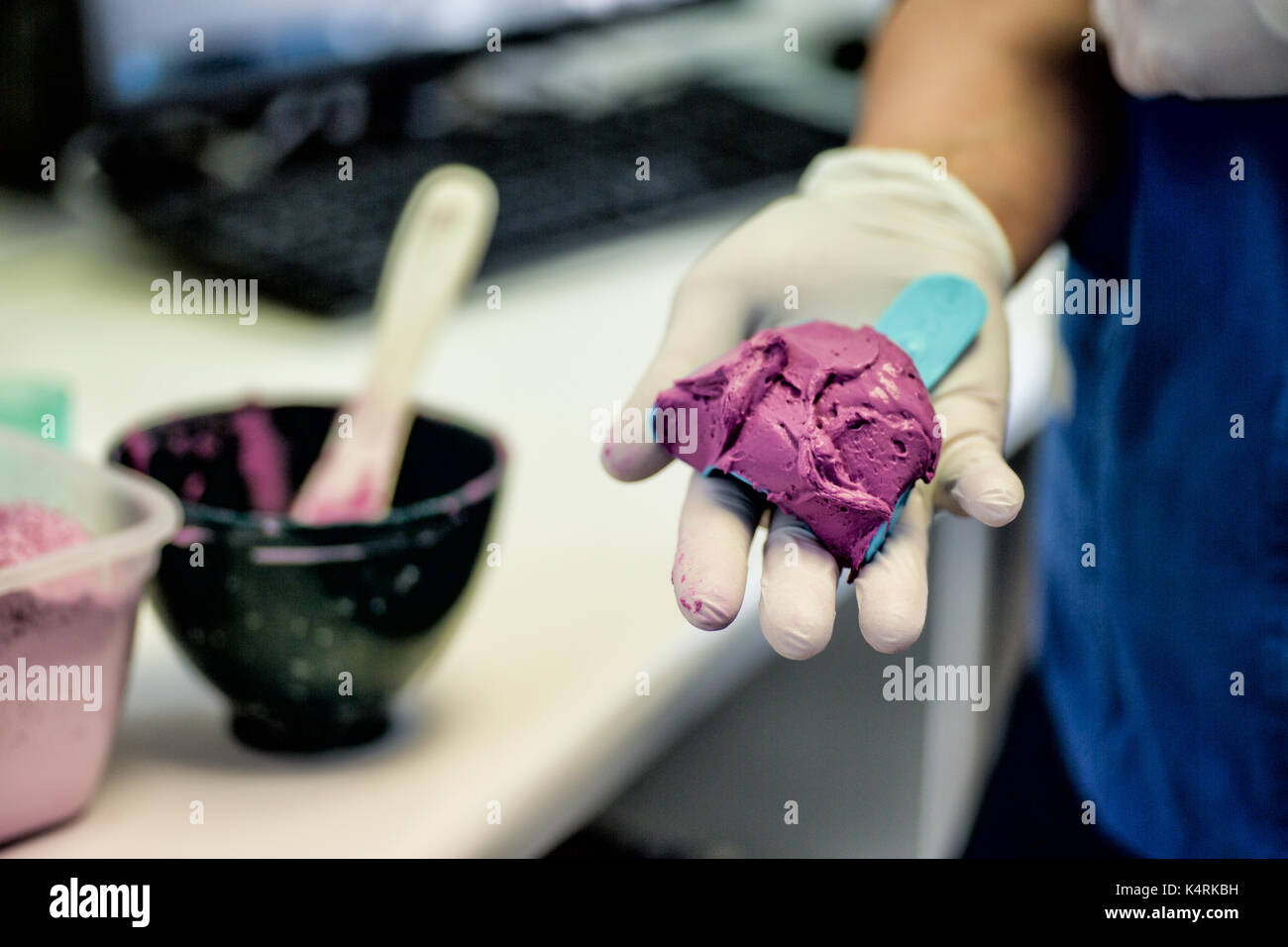 Mixed Dental Alginate Impression material used to make negative impressions of the teeth and soft tissues in the mouth for diagnostic studies. Stock Photo