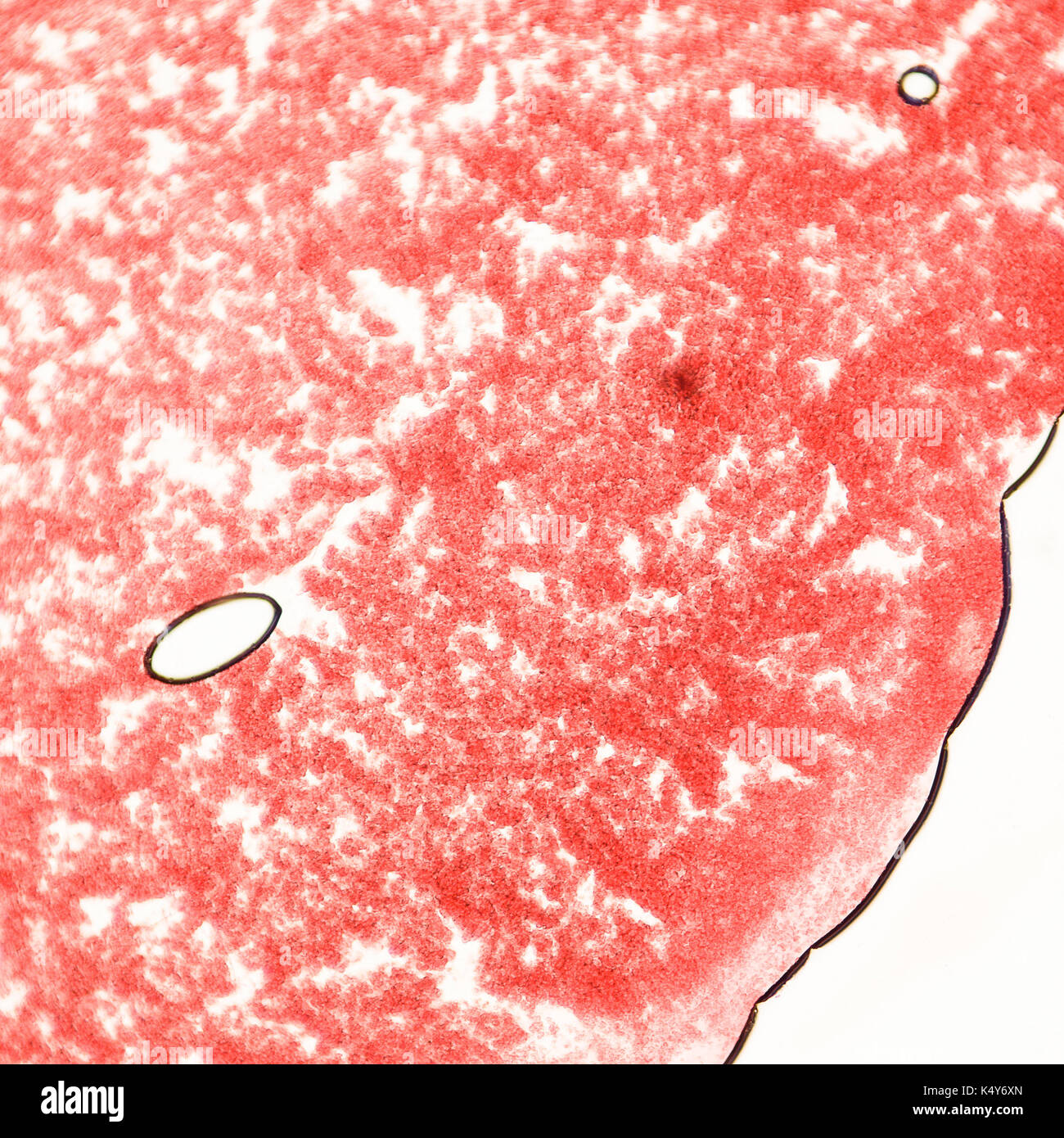 Blood smear under microscope present neutrophils and red blood cells