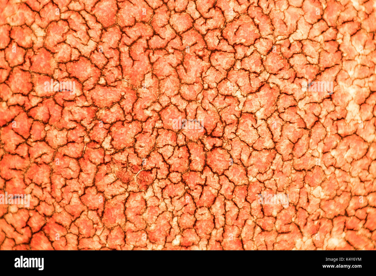 Solidified coagulated blood seen on a 100x microscope view. Blood smear under microscope present neutrophils and red blood cells Stock Photo