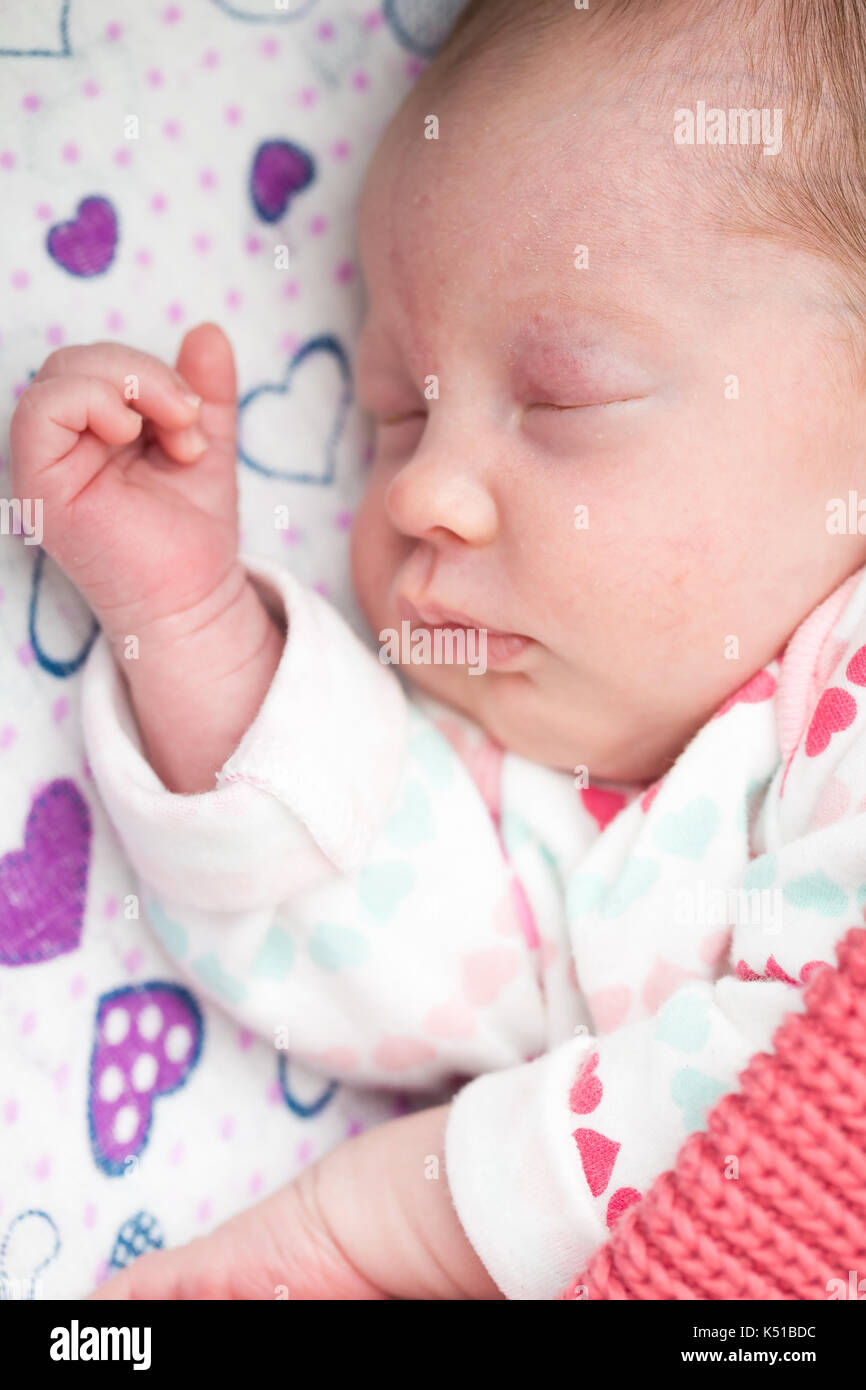 Newborn baby sleeping in the crib; stork bite on her forehead and eyelid Stock Photo