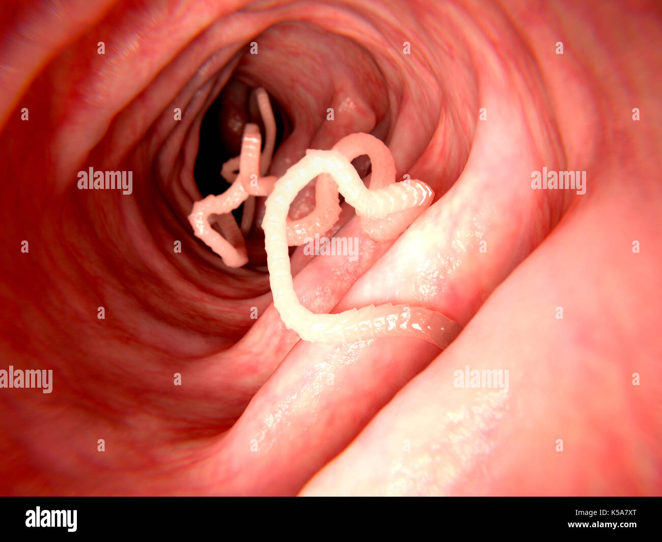 Illustration of a tapeworm in a human intestine. Tapeworms (Taenia sp.) are parasites that inhabit the human gut. They anchor themselves to the inside of the intestine and absorb nutrients through their body wall. Tapeworms may grow to several metres in length, but infestation does not necessarily cause symptoms. Stock Photo