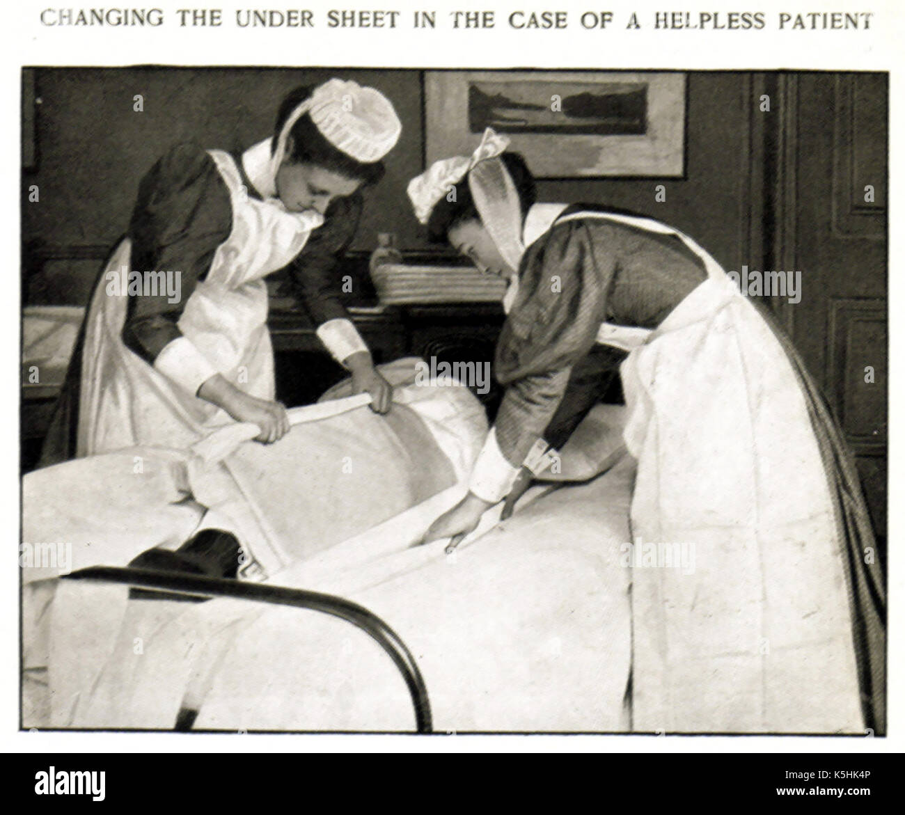 1912 English nurses changing a bed under-sheet for a helpless patient Stock Photo