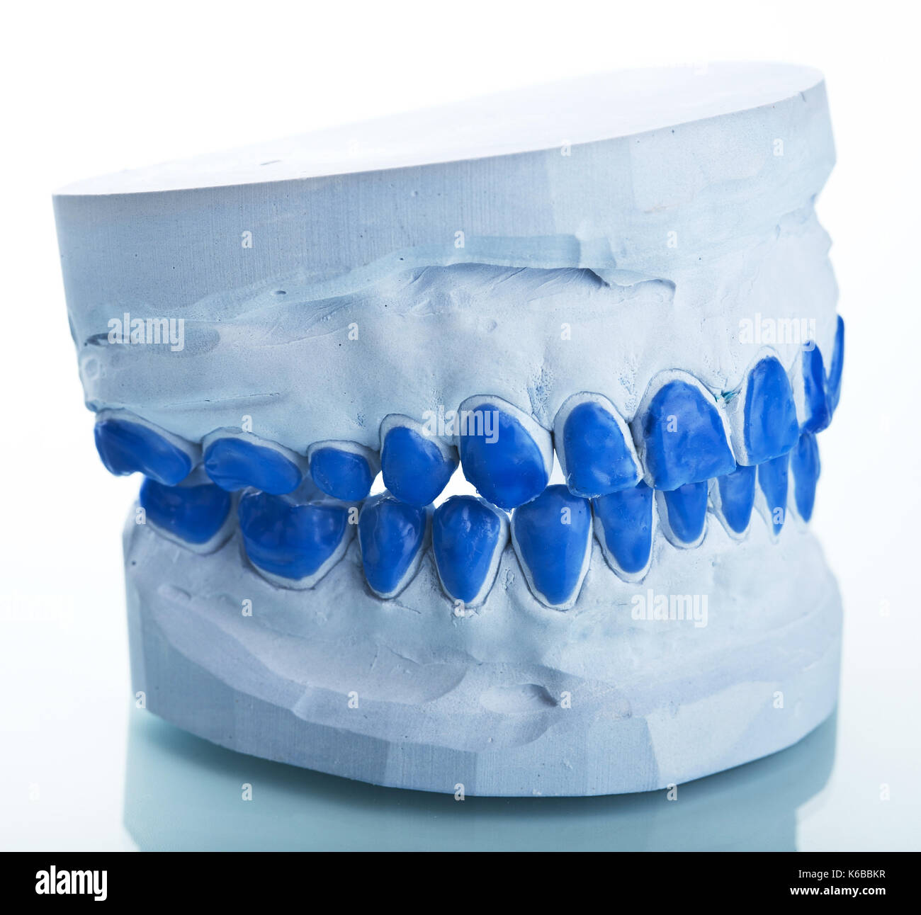 individual plaster dental molds to make trays Stock Photo Alamy