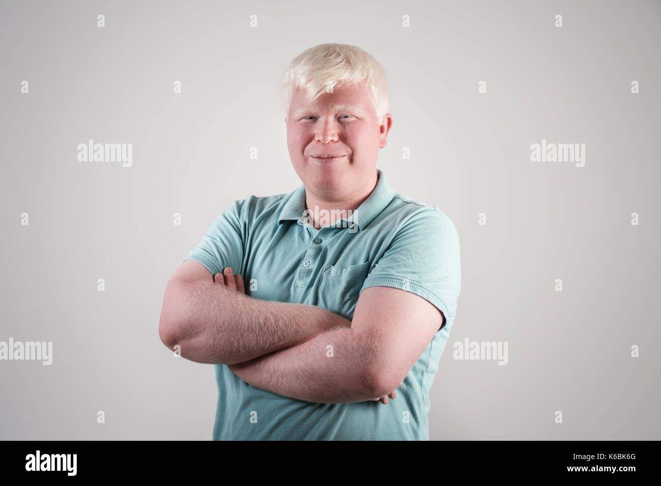 Albino young man portrait. Blond guy isolated at white background. Albinism, pale skin. Stock Photo