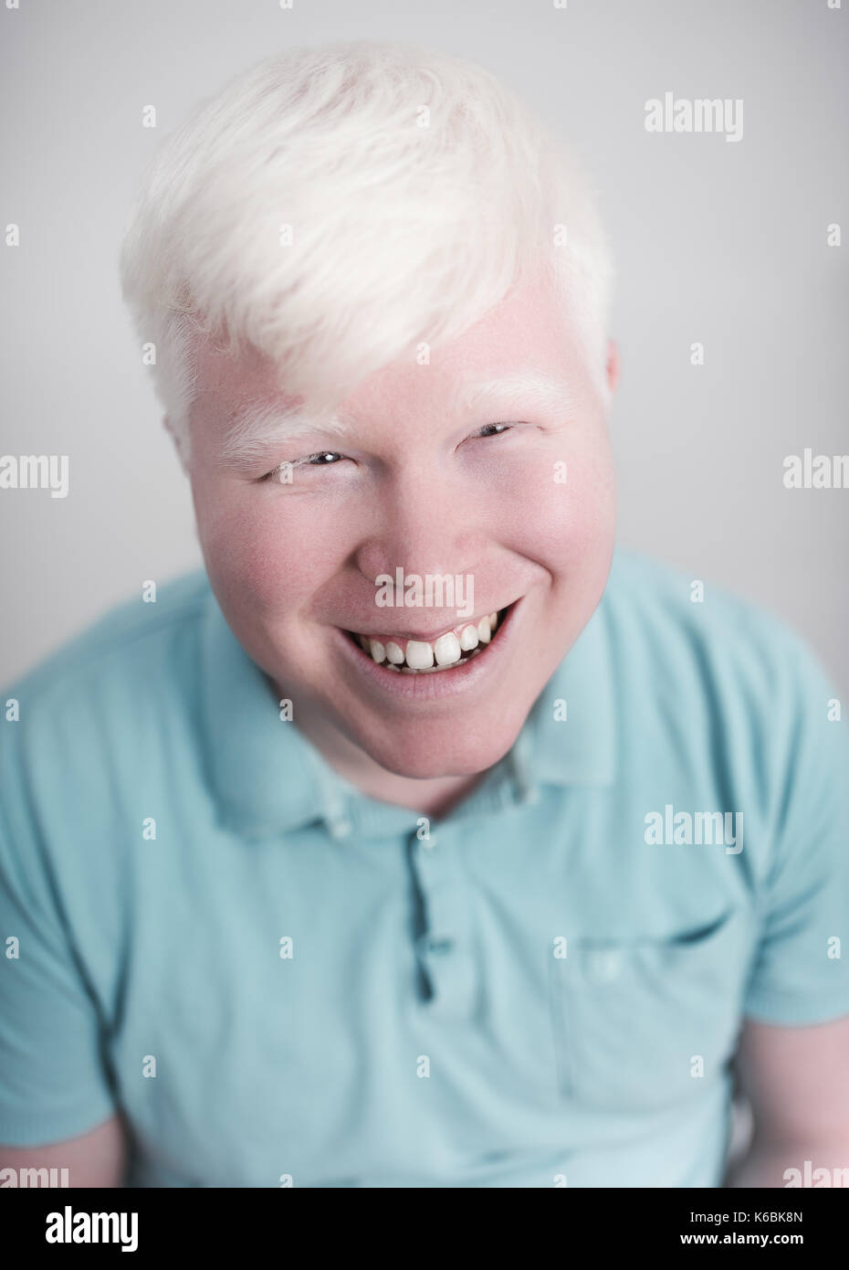 Albino young man portrait. Smiling guy isolated at white background. Albinism, pale skin. Stock Photo