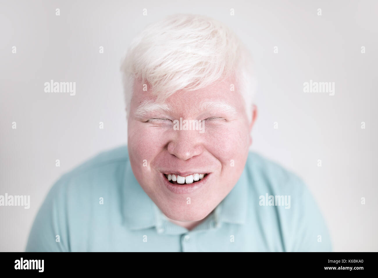 Albino young man portrait. Smiling man isolated at white background. Albinism, pale skin. Stock Photo