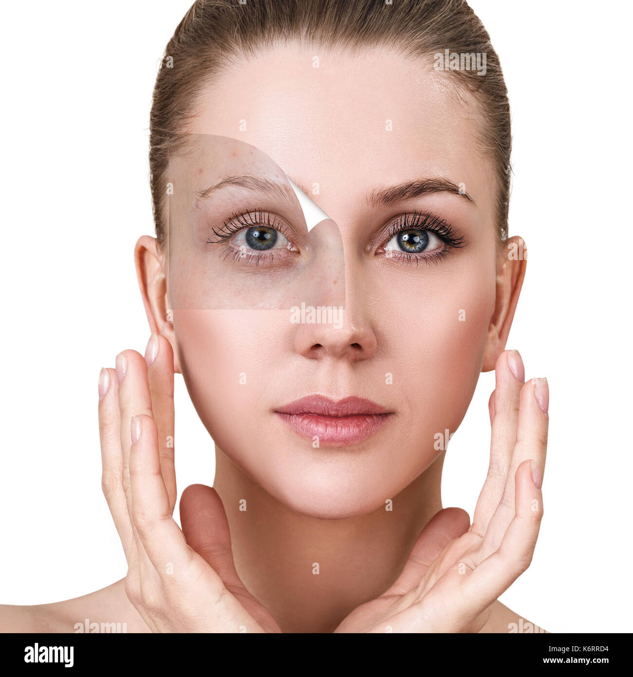 Woman face before and after treatment skin Stock Photo Alamy