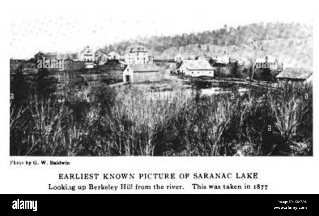 Early Picture of Saranac Lake 1877 ALD Stock Photo