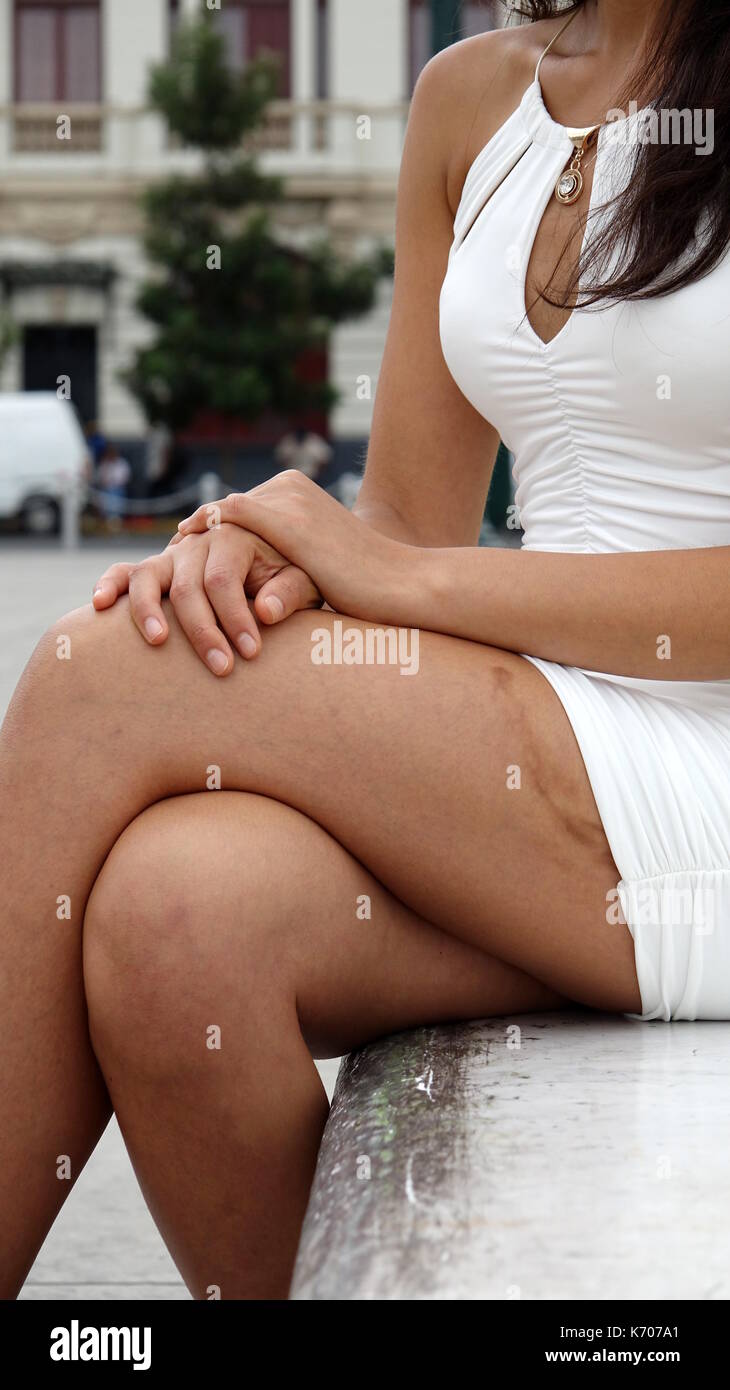 https://c8.alamy.com/comp/K707A1/a-female-with-scar-on-leg-K707A1.jpg