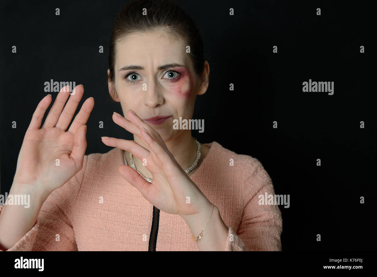 Home violence. Beaten woman with injuries on face, bleeding, black eye. Woman defending herself. Stock Photo