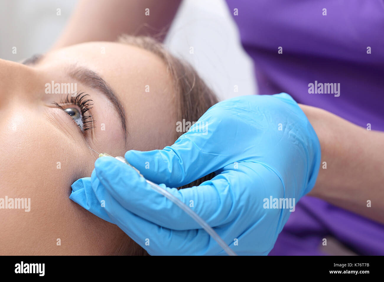 Aesthetic medicine, facial skin scraping.The doctor of aesthetic