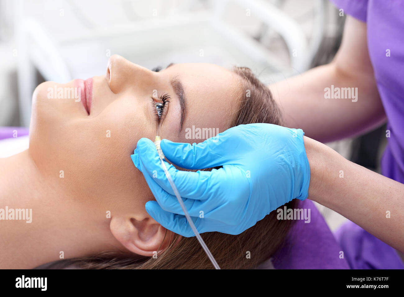 Rejuvenating treatment, a woman in a beauty parlor. The doctor of aesthetic medicine performs a facial skin scraping treatment with a syringe. Stock Photo