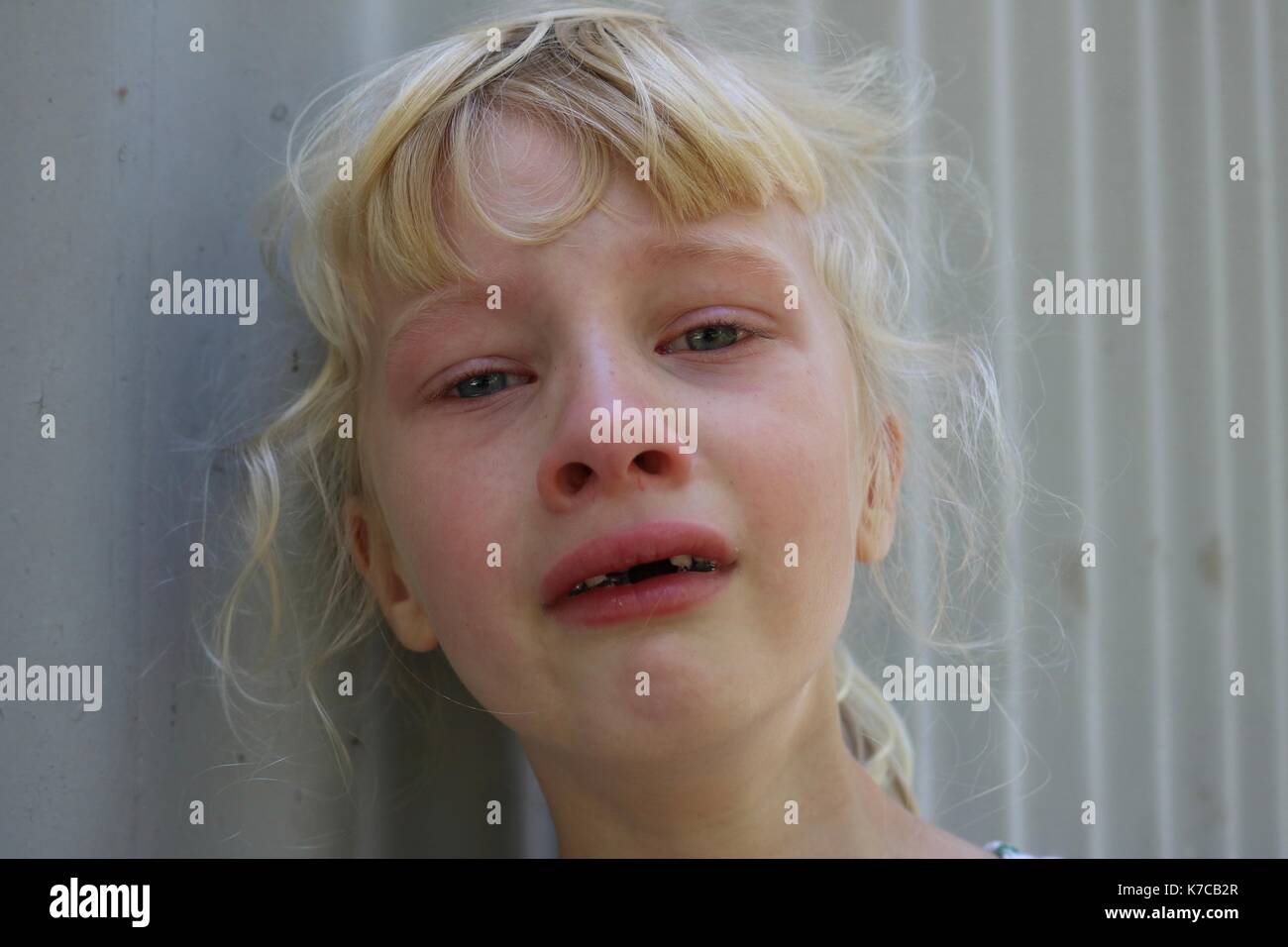 Young girl crying in pain Stock Photo