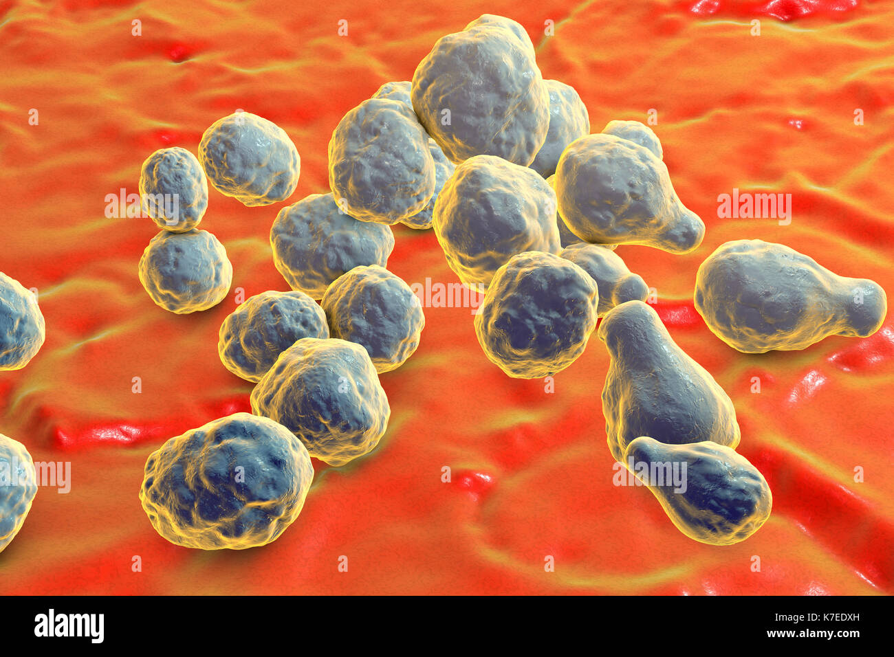 Cryptococcus neoformans fungus, computer illustration. C. neoformans is a yeast-like fungus that reproduces by budding. An acidic mucopolysaccharide capsule completely encloses the fungus. It can cause the disease cryptococcosis, especially in immune deficient patients, such as those with HIV/AIDS (acquired immunodeficiency syndrome). It can infect the brain, causing meningitis or brain abscesses, lungs or skin. The most common clinical form is meningoencephalitis. It is caused by inhaling the fungus from soil that has been contaminated by pigeon droppings. Stock Photo